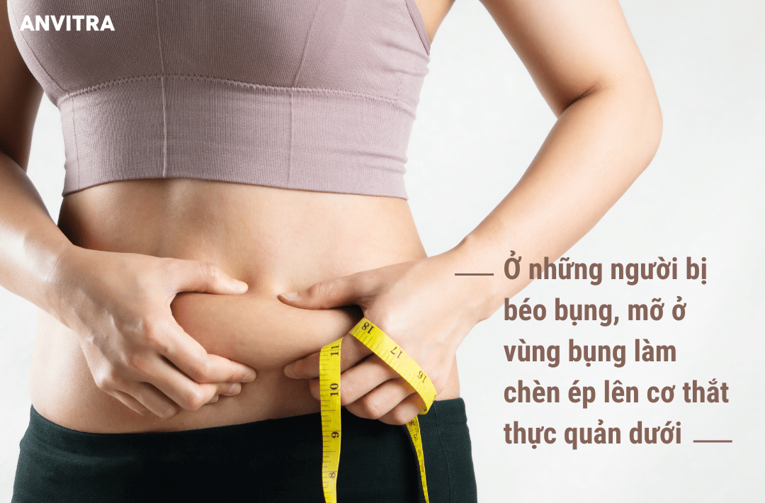 Ở những người bị béo bụng, mỡ ở vùng bụng làm chèn ép lên cơ thắt thực quản dưới 