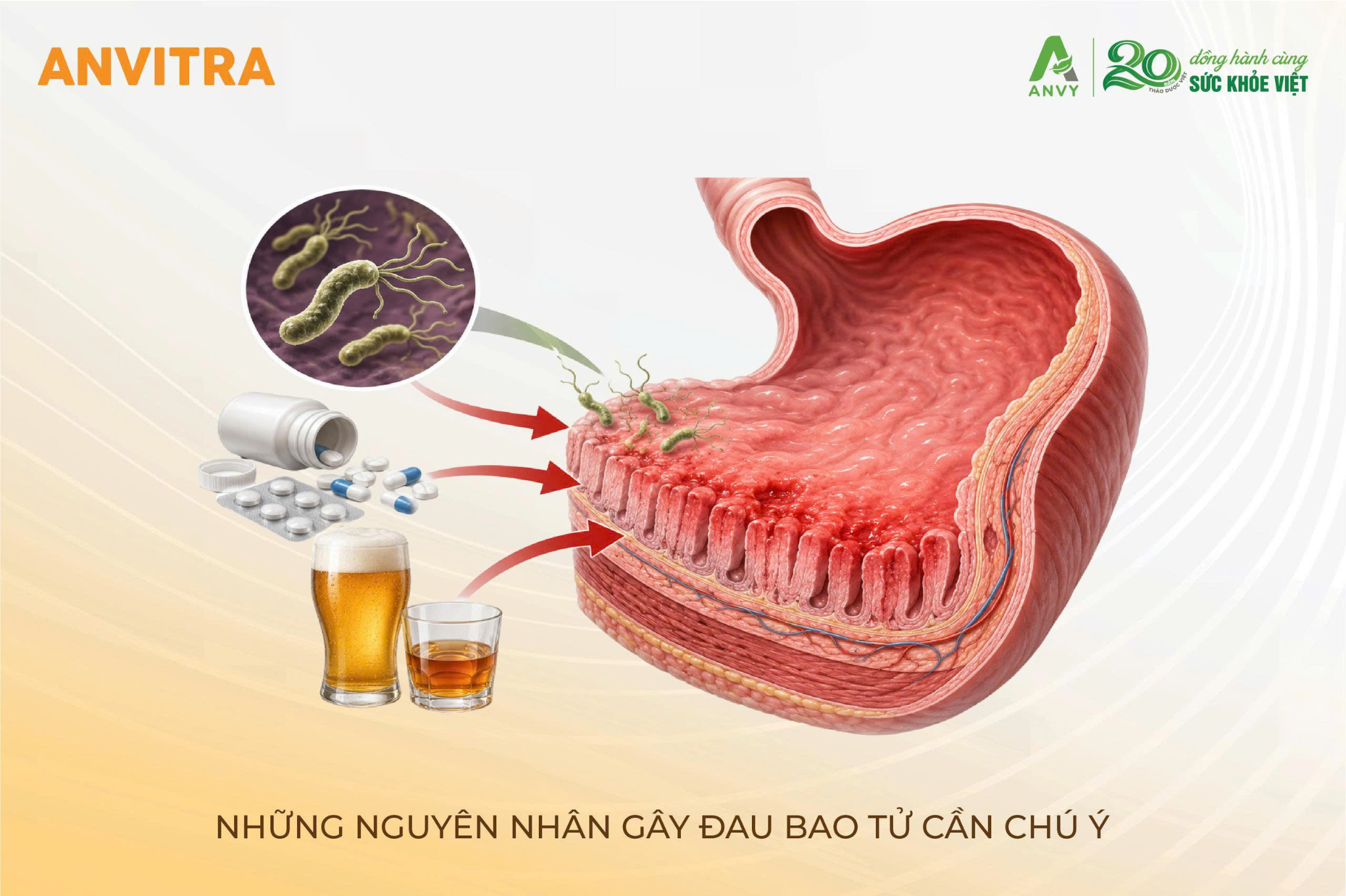 Những nguyên nhân quan trọng cần lưu ý khi đau dạ dày tái diễn