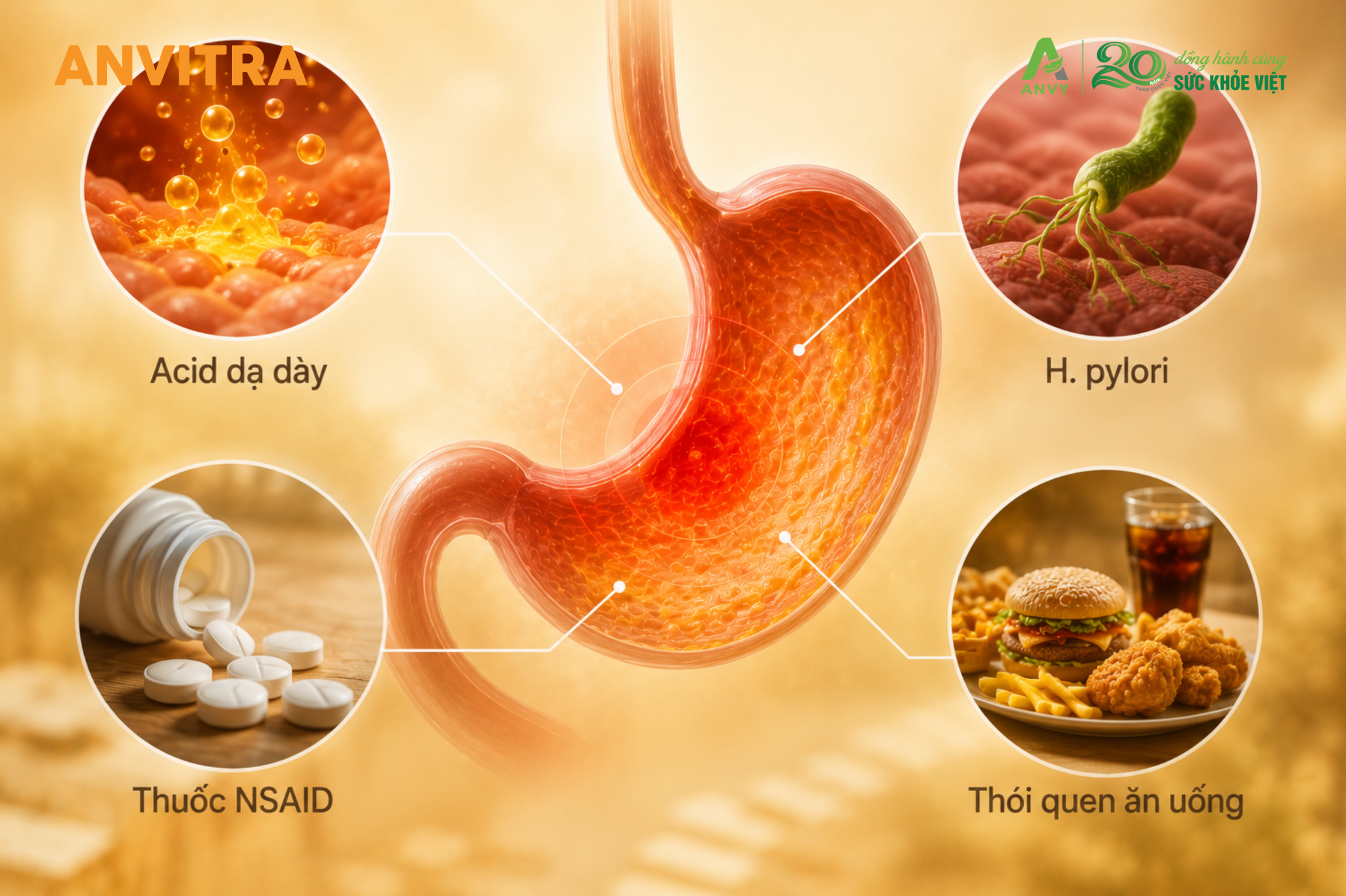 Các nguyên nhân phổ biến gây đau dạ dày