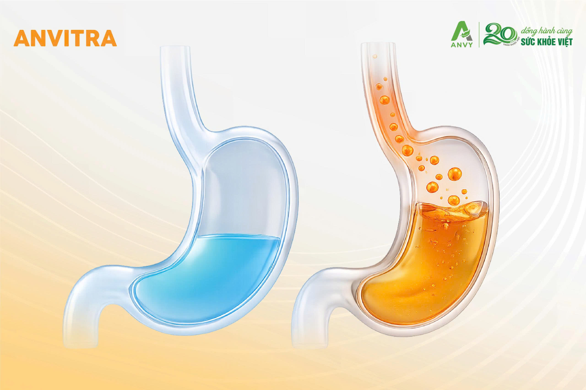 Acid trào ngược lên thực quản có thể gây nóng rát vùng ngực và cổ họng.
